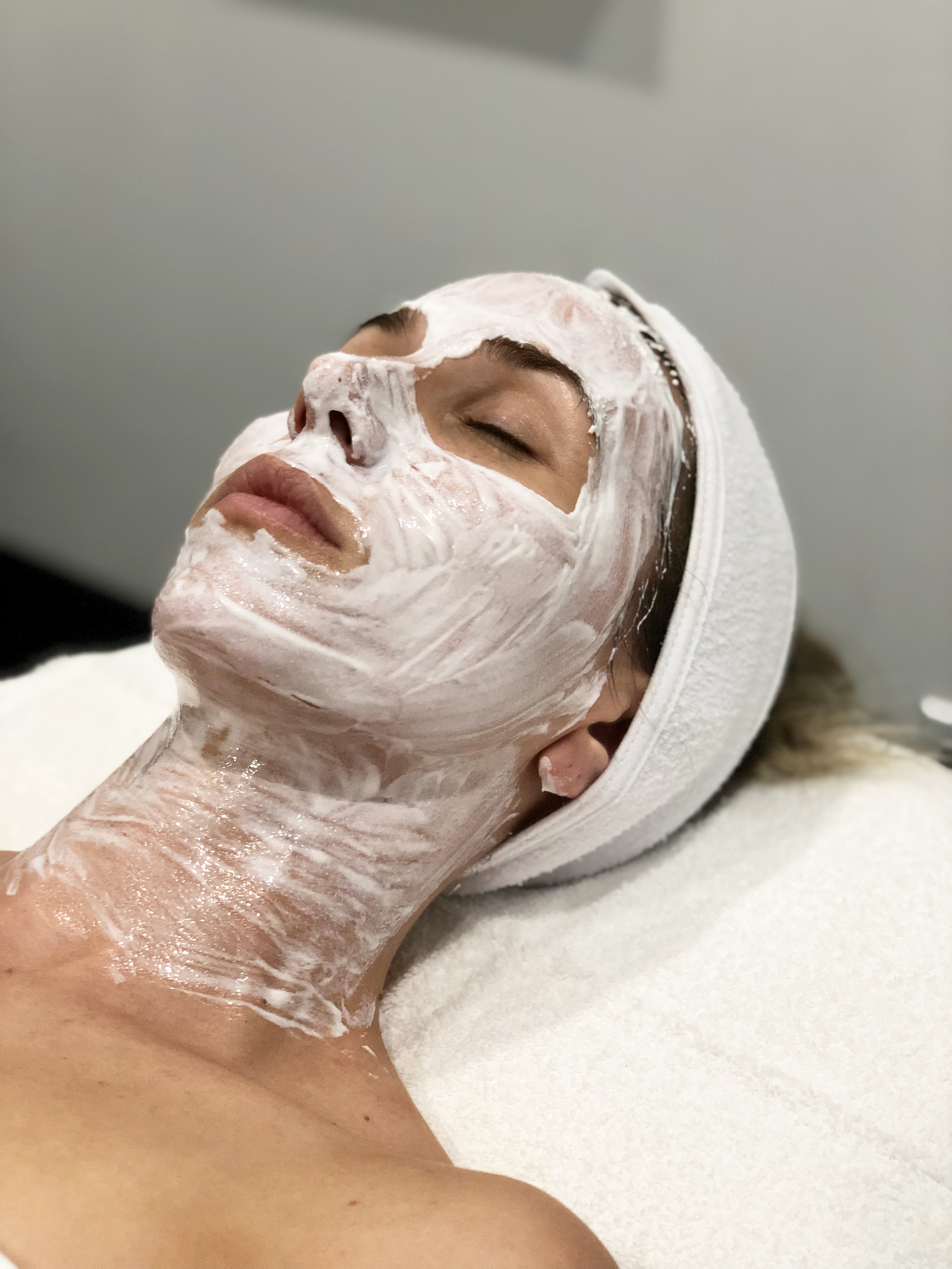 Everything you need to know about microneedling