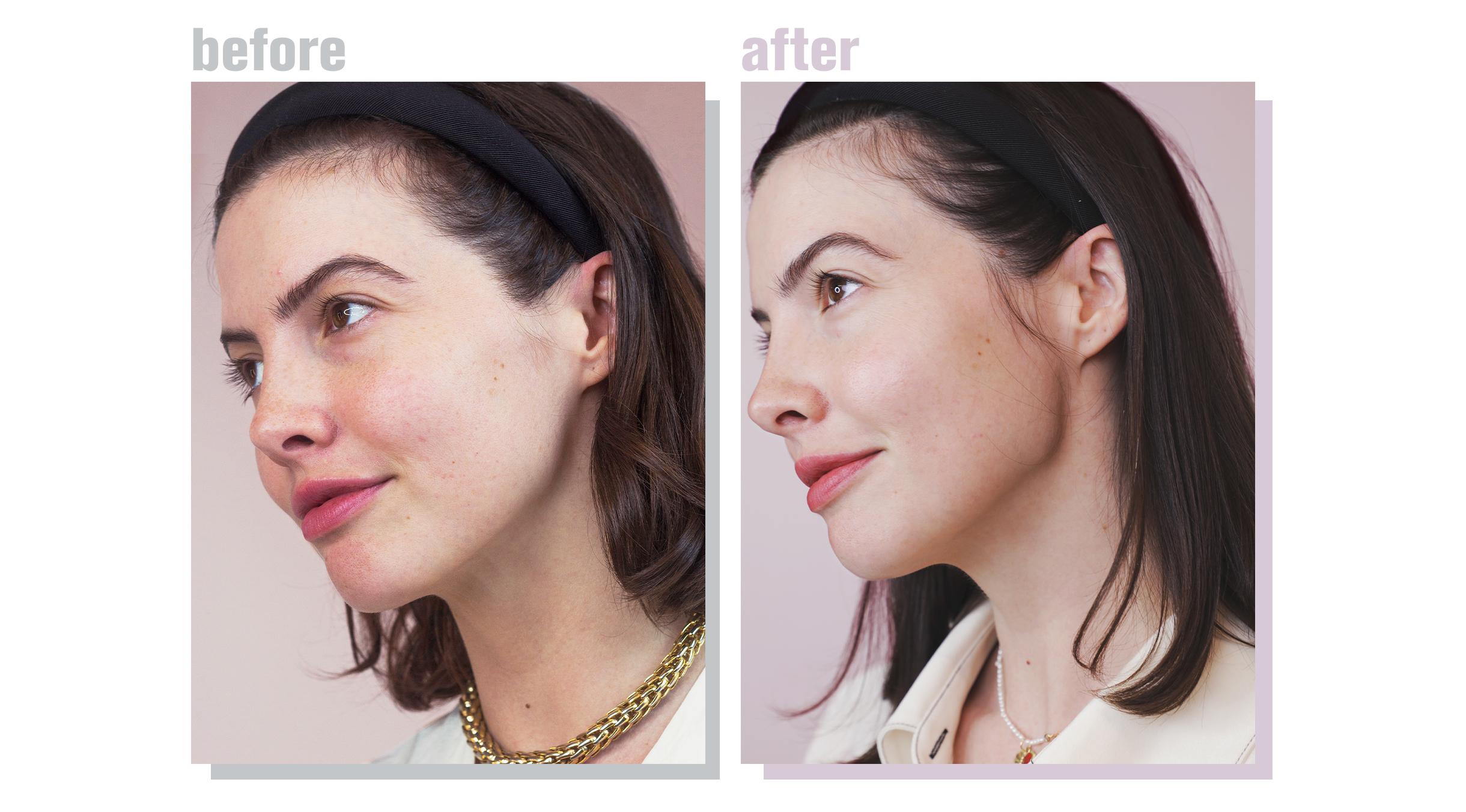 Anti-Aging Skincare Routine for 30s Before and After