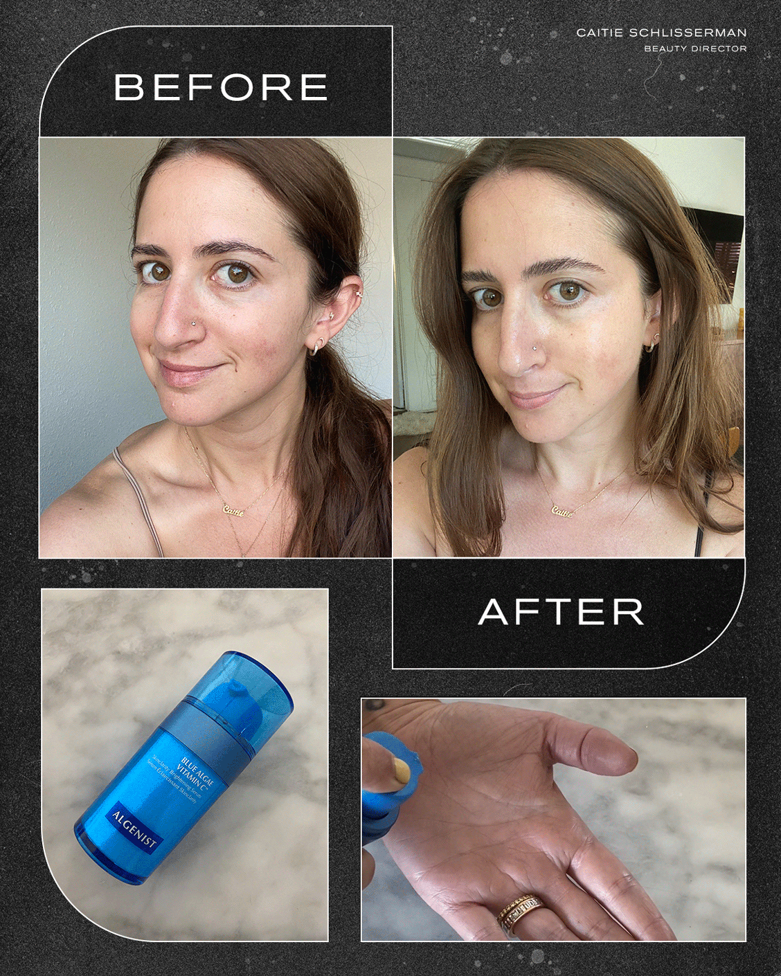 Vitamin C Serum Before And After Pictures Who What Wear