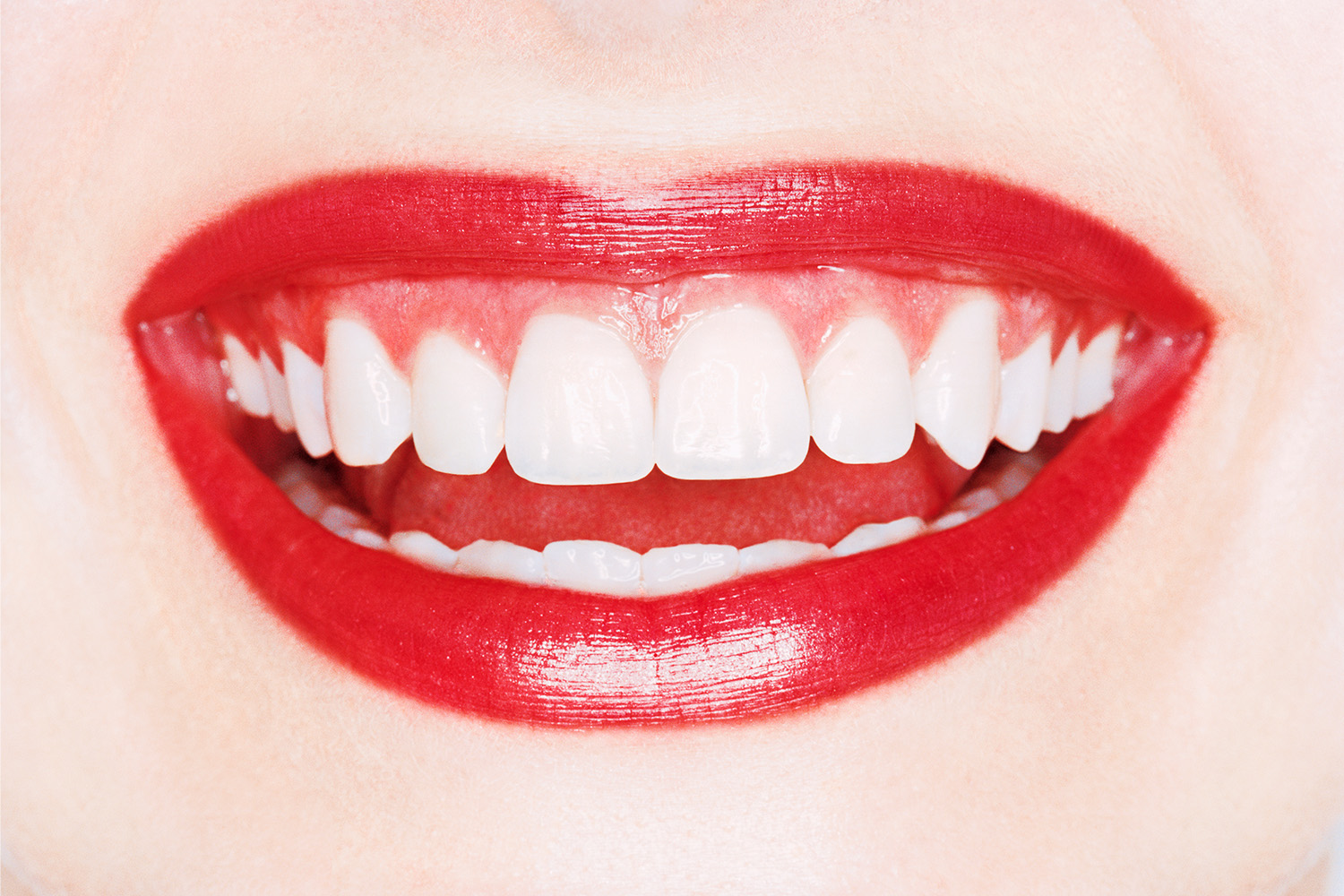 best teeth whitening products 296268 1636747311818