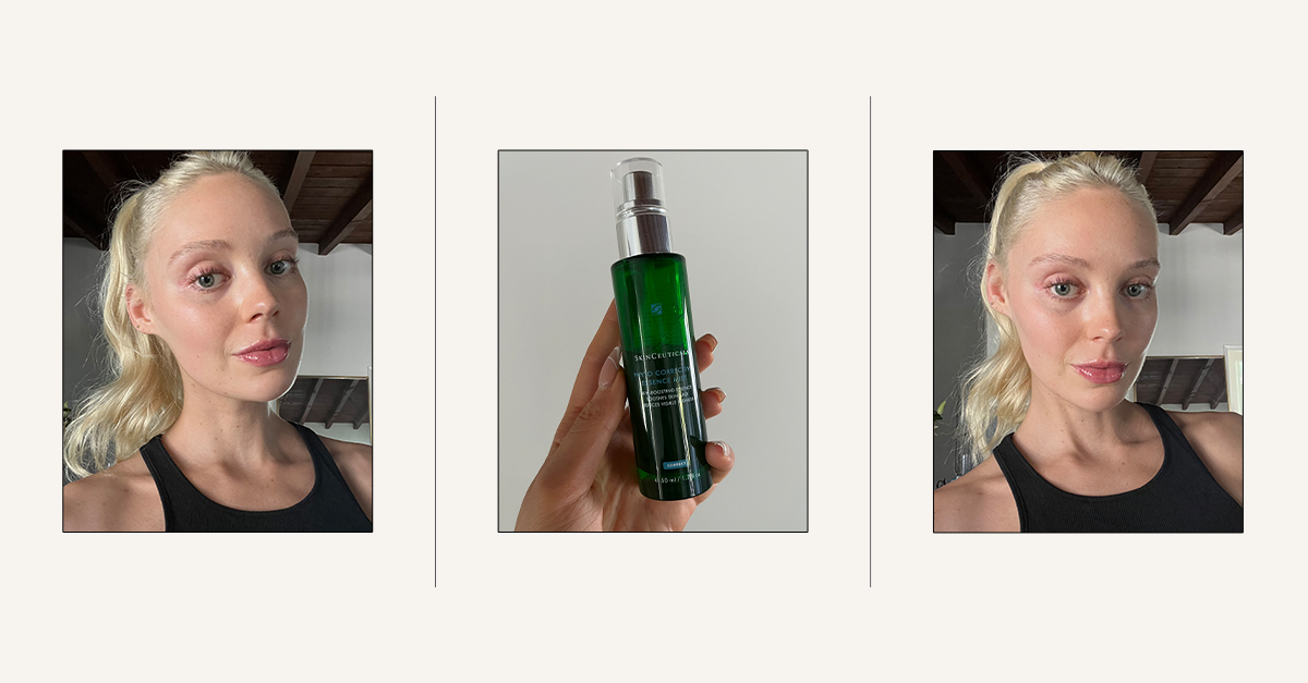 Honestly, I Love It: The New Face Mist That Banished My Redness—Instantly