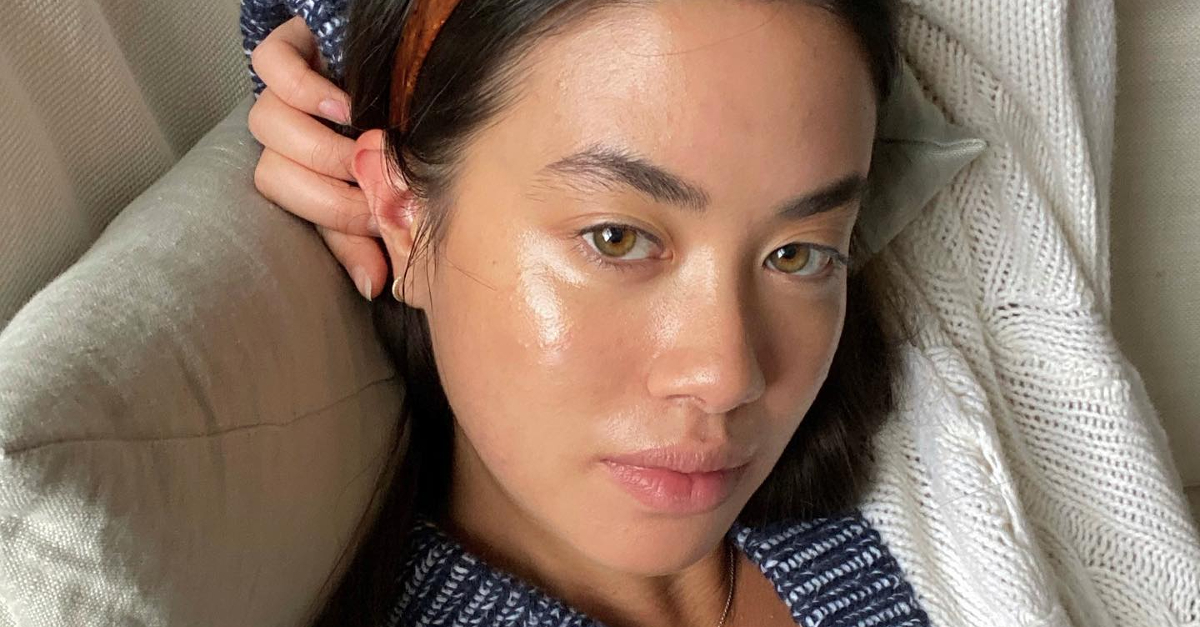 These 15 Moisturizers Are the GOAT for Pimples-Susceptible Pores and skin